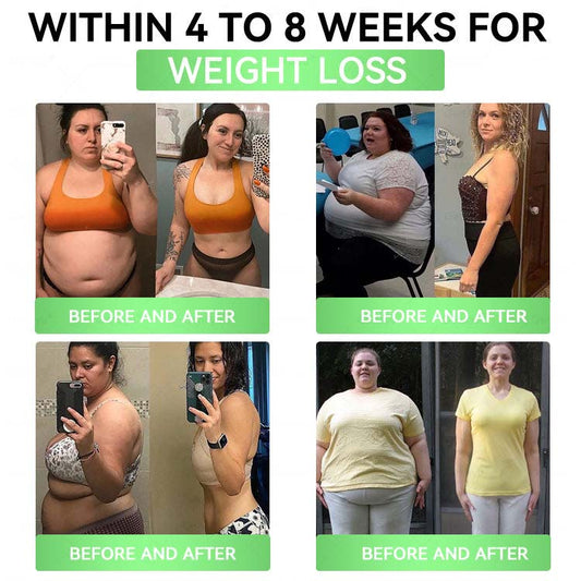 Aprolo™ Slimming Patch – Effortless Body Shaping Support 🌿🩹