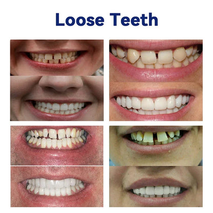 Advanced Customized Full Denture Set🦷