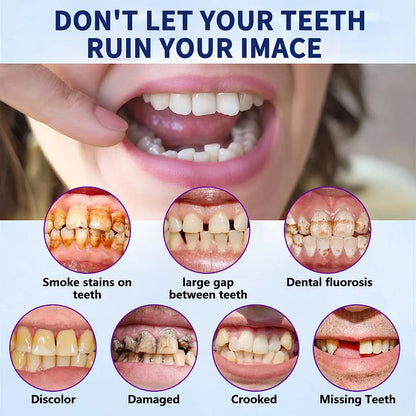 Advanced Customized Full Denture Set🦷