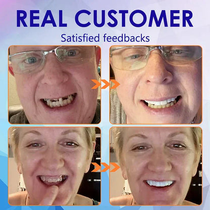 Advanced Customized Full Denture Set🦷