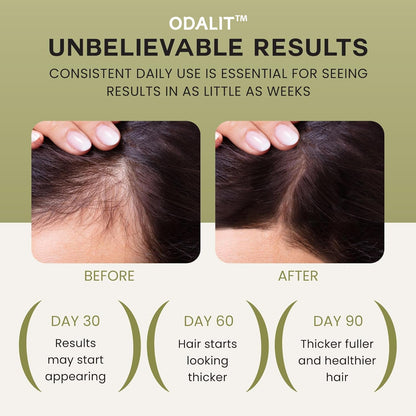 🔥LAST DAY SALE-60% OFF -ODALIT™ Wonder Growth Oil