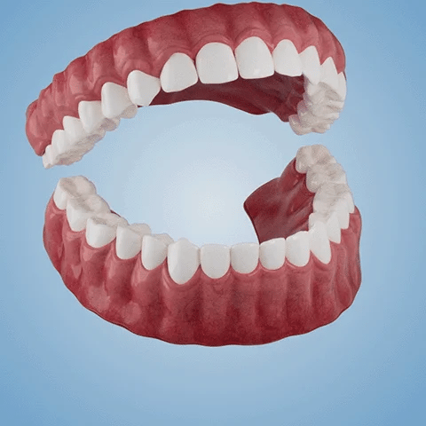 Advanced Customized Full Denture Set🦷