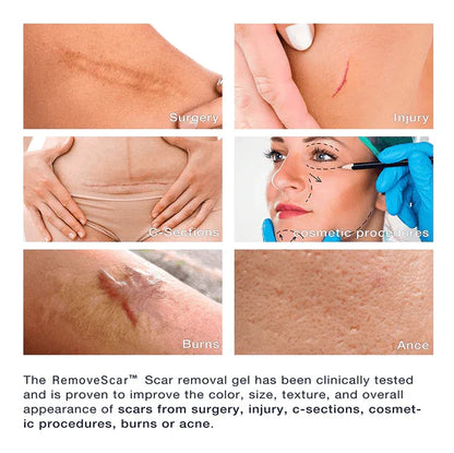 Aprolo™ German Advanced Skin Renewal Gel