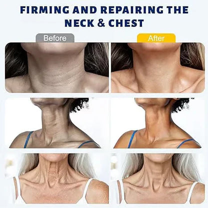 MAGEC Collagen Fullerene Neck Cream With Retinol & Peptides
