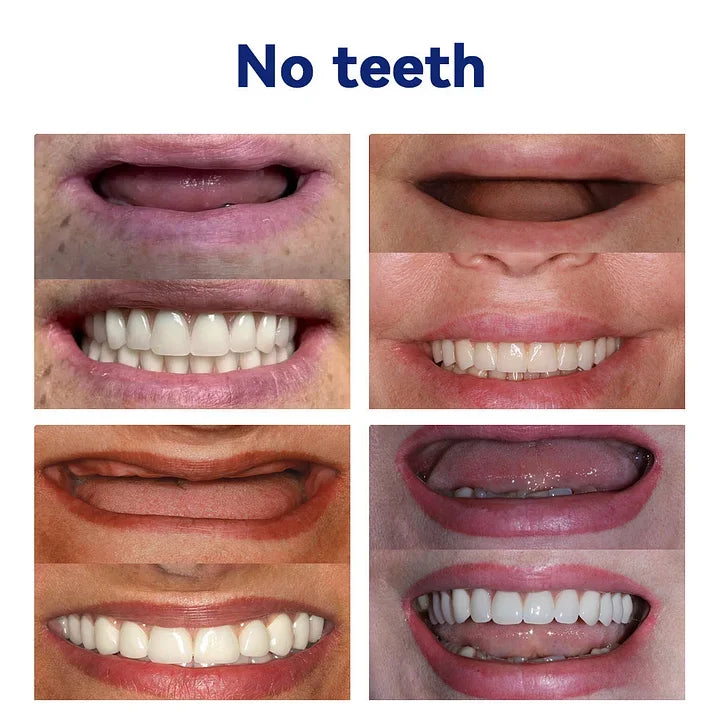 Advanced Customized Full Denture Set🦷