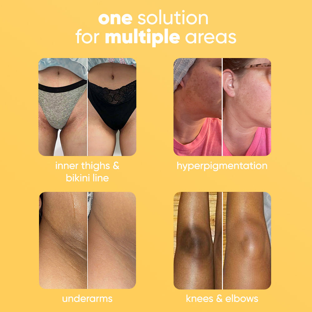 Kojic & Turmeric Bar