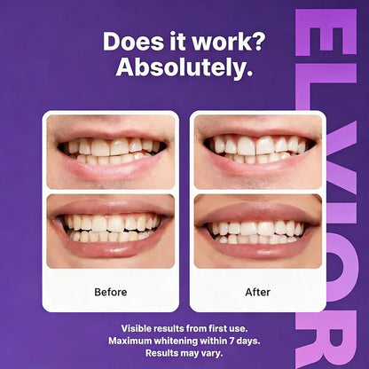 DR Whitening Strips
