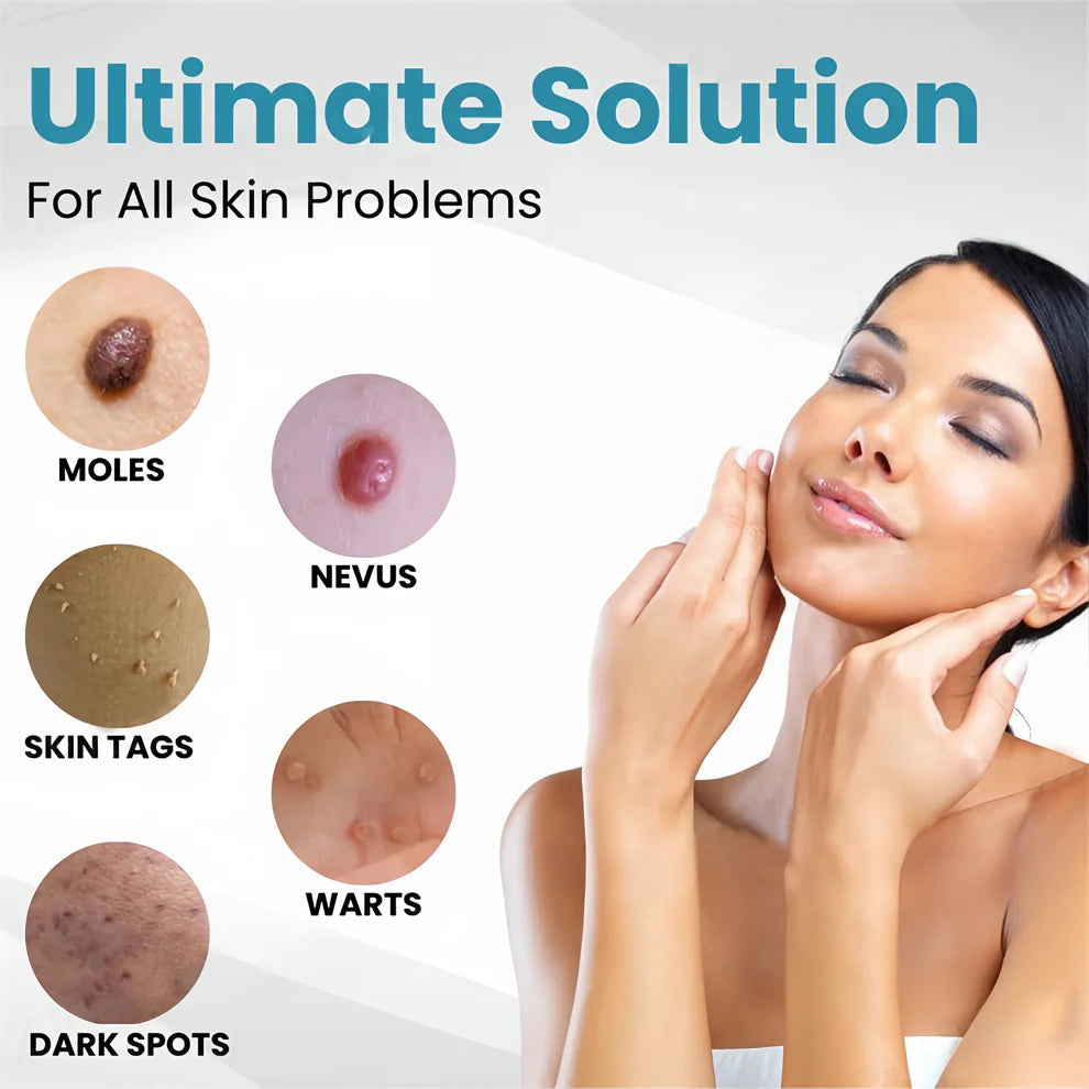 Aprolo™ Non-invasive Mole and Wart Removal Laser Pen