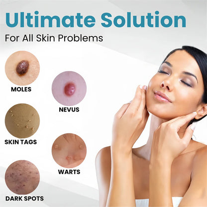 Aprolo™ Non-invasive Mole and Wart Removal Laser Pen