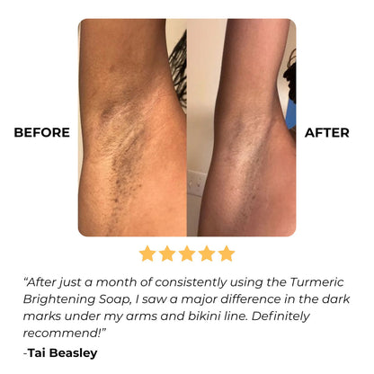Kojic & Turmeric Bar